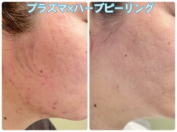 フルオール(FRUOR)