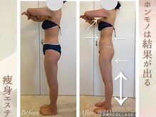 ラナ(LaNa)/セルライト撃退後の変化