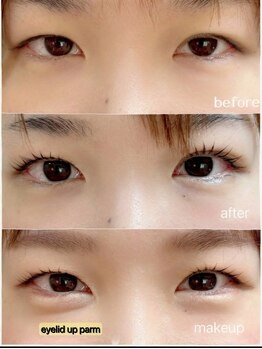 プリティアイ(pretty eye)/【NEW】アイリッドアップパーマ