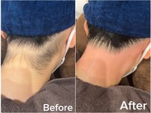 ジョエルワックス 沖縄那覇店(JOELLE WAX)/気になる！！おくれ毛脱毛★