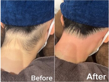 ジョエルワックス 沖縄那覇店(JOELLE WAX)/気になる！！おくれ毛脱毛★