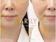 アリリィ(ARILY)/ARILY after care salon