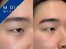 エムディアリリー(M DIALILY.)/