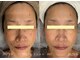 モミン(MOMI.N)の写真/シミもくすみもなかったことに、光の力で肌を一新し透明感あふれる美肌へ導くケア60分4500円