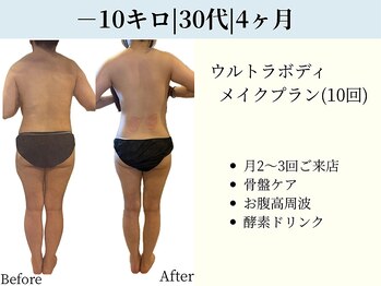 京都フォーエイチ(京都4H)/－10キロ|4ヶ月|30代|人生初成功