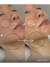 ドルチェビューティーサロン 戸塚安行店(Dolce Beauty Salon)/ダクトピール
