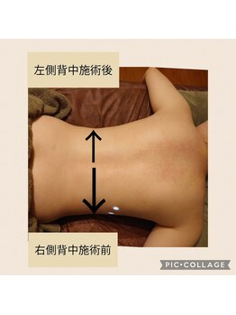 リベラ(LIBERA)/背中も引き締まる★