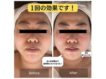 チョアチョア(CHOA-CHOA)の雰囲気（最新韓国肌管理＆韓国コルギ・カッサが受けられます♪【コルギ】）