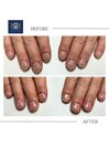 【ネイルケア】before/after