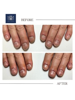 【ネイルケア】before/after