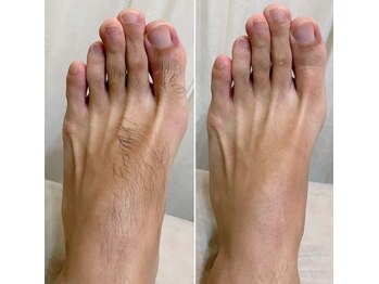 ナチュラヒルズ(Naturahills)/