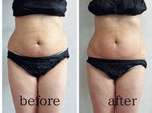 スリーエレメンツ(THREE ELEMENTS)/ビフォーアフター♪