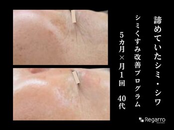 レガロビューティクリエイションズ桜川店/シミに終止符！シミを作らない肌