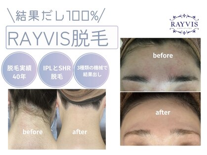 レイビス 郡山店(RAYVIS)の写真