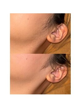 銀座シノ 灯 HANARE(shino)/もみあげや耳もシェービング