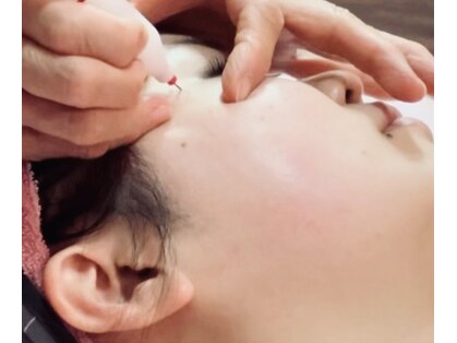 トータルエステ ユキ(YUKI)の写真