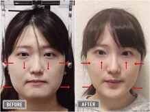 さつま骨格矯正 表参道青山院/歪み小顔矯正＋骨盤矯正