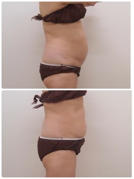 ソワンマリア(soin Maria)/痩身コース1ヶ月の結果です♪