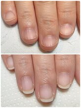 スマイルニコ(smile nico)/反り爪