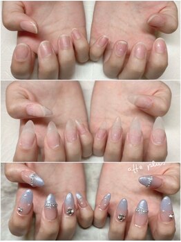 アフェプラス トータルビューティーサロン 香里園店(affe+ total beauty salon)の写真/深爪や小さい爪でお悩みの方もお任せ！チップやスカルプを用いた長さ出しでコンプレックスを解消♪