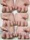 アフェプラス トータルビューティーサロン 香里園店(affe+ total beauty salon)の写真/深爪や小さい爪でお悩みの方もお任せ！チップやスカルプを用いた長さ出しでコンプレックスを解消♪