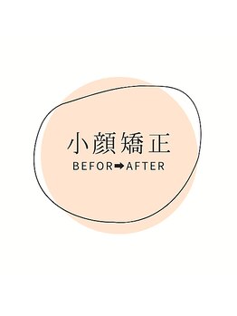 円山カラダ/小顔矯正　ビフォーアフター