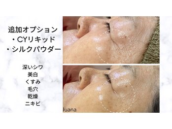 ルアナ(Luana)/【人気NO.1】陶肌トリートメント