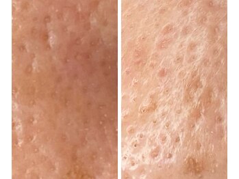 サイ(Sai)/before⇒after