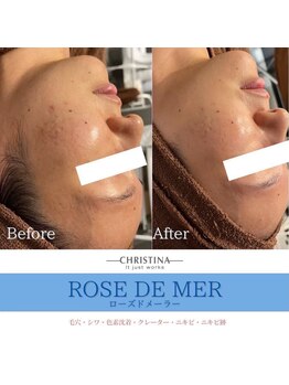 フルアナ(Hu ruana)/フェイシャルエステ