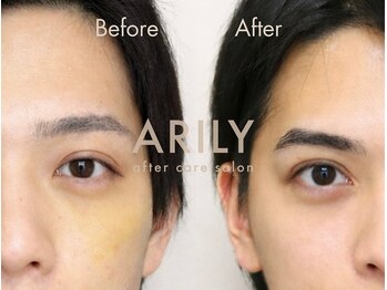 アリリィ(ARILY)/ARILY after care salon