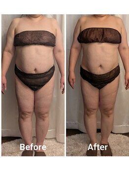 フィニシオン/50代 &nbsp;&nbsp;&nbsp;120分1回