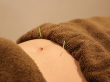 【妊活・マタニティ・美容鍼】鍼とお灸のお店 Colza