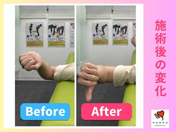 ナオル整体 川越院(NAORU整体)/肩の痛みが解消【整体/矯正】