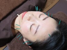 はりめぐりの雰囲気（美容鍼/9割初めて◎むくみスッキリ髪の毛より細い鍼使用）