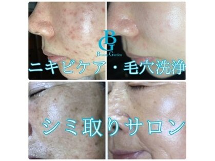 ビューティーガーデン(Beauty Garden)の写真