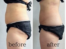 スリーエレメンツ(THREE ELEMENTS)/ビフォーアフター♪