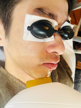 サロントゥエンティーフィフスアベニューニコ(Salon 25th ave.)/☆ヒゲ脱毛/ひげ脱毛☆