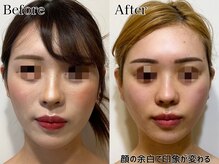 プルチャームエテルナ 代官山店(Pulchram eterna)/ライン矯正+リンパ+機械