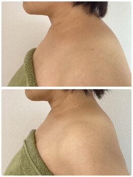 トリートメントルーム フェリーチェ(Felice)/背中スッキリ!小顔フェイシャル