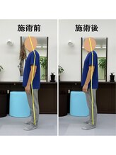 コウジュウドウプラス(耕揉堂Plus+)/首・背中を緩めて姿勢改善！