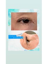 シュピネ(Choupinet)/◯クレセントムーンロッド◯