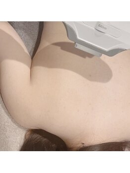 スリープイン 東武宇都宮店(Sleep in)/お背中の準備、出来ていますか?