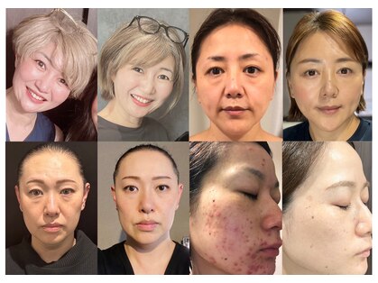 ランコントル(Rencontre)の写真