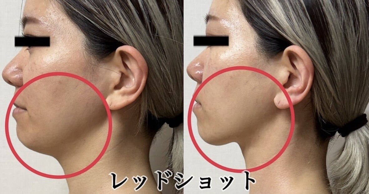 毛穴専科｜ホットペッパービューティー