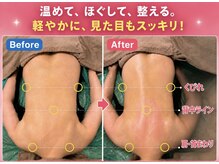 ソルーブ 広尾店/BeforeAfter
