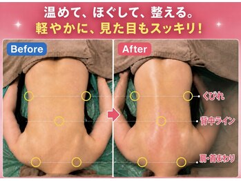 ソルーブ 広尾店/BeforeAfter