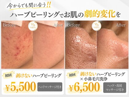 プリュボーテ 吉祥寺(Pul Beaute)の写真
