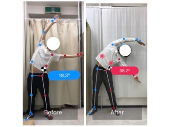 ナオル整体 三鷹院(NAORU整体)/20代男性施術事例【体幹側屈】