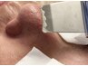 『押し出さない』毛穴洗浄！気になる毛穴をお掃除FACIAL8000円☆