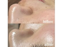 ブリリアント(brilliant)/フェイシャルワックス